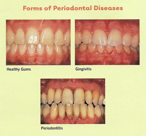 dental courses in india